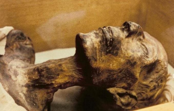 mummia del cervello è rimasto intatto.